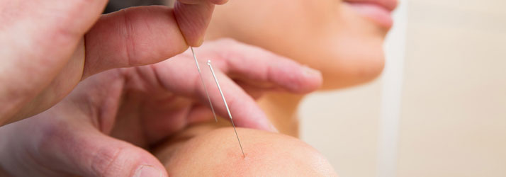 Energy Medicine in Eustis FL: Chiropractic + Acupuncture = Genius
